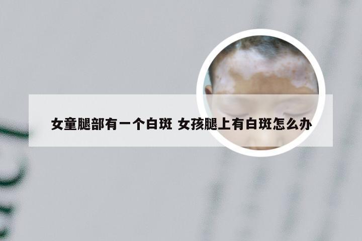 女童腿部有一个白斑 女孩腿上有白斑怎么办