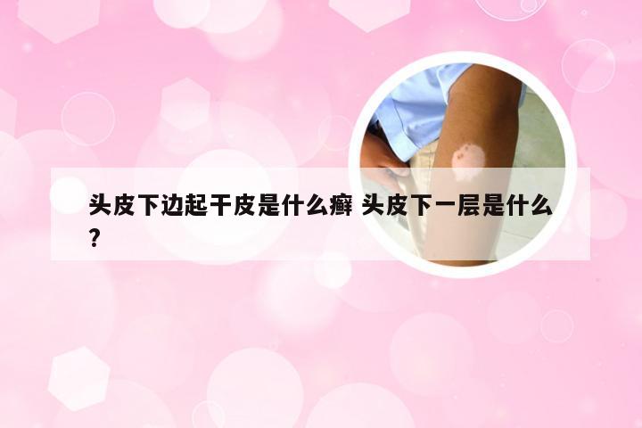 头皮下边起干皮是什么癣 头皮下一层是什么?