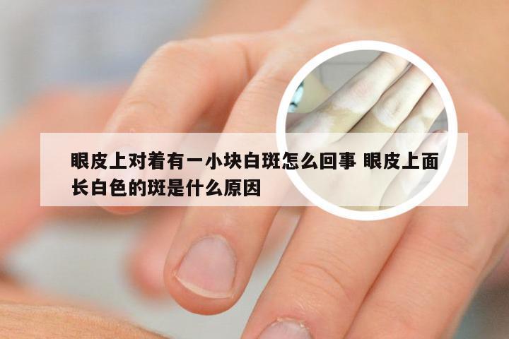 眼皮上对着有一小块白斑怎么回事 眼皮上面长白色的斑是什么原因