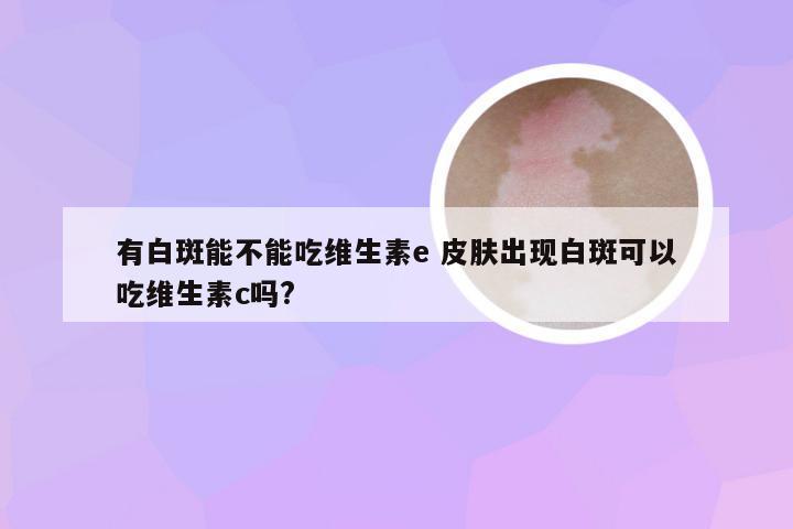 有白斑能不能吃维生素e 皮肤出现白斑可以吃维生素c吗?