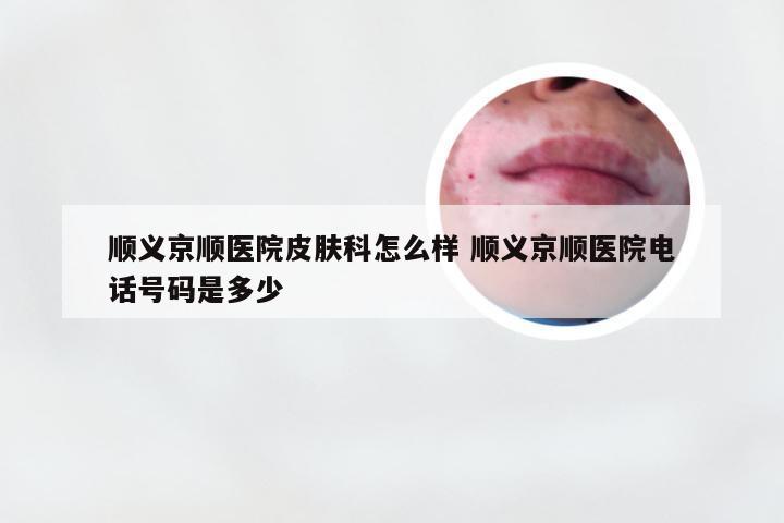 顺义京顺医院皮肤科怎么样 顺义京顺医院电话号码是多少