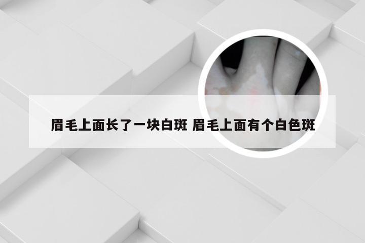 眉毛上面长了一块白斑 眉毛上面有个白色斑
