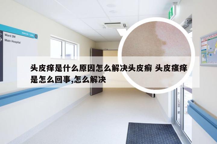 头皮痒是什么原因怎么解决头皮癣 头皮瘙痒是怎么回事,怎么解决