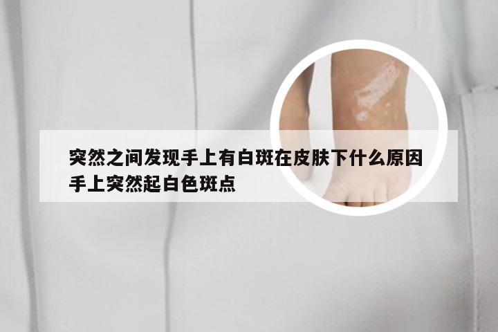 突然之间发现手上有白斑在皮肤下什么原因 手上突然起白色斑点