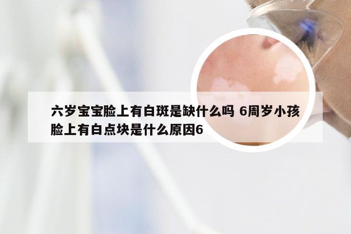 六岁宝宝脸上有白斑是缺什么吗 6周岁小孩脸上有白点块是什么原因6