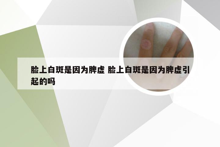 脸上白斑是因为脾虚 脸上白斑是因为脾虚引起的吗