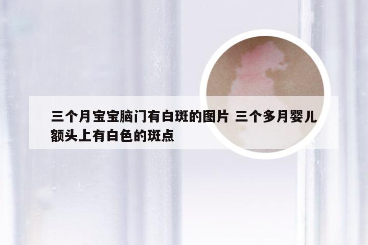 三个月宝宝脑门有白斑的图片 三个多月婴儿额头上有白色的斑点