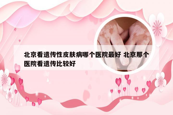 北京看遗传性皮肤病哪个医院最好 北京那个医院看遗传比较好