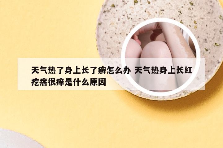 天气热了身上长了癣怎么办 天气热身上长红疙瘩很痒是什么原因