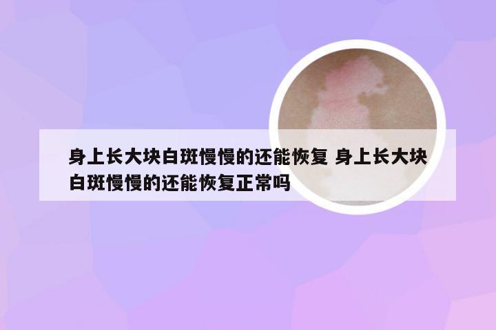 身上长大块白斑慢慢的还能恢复 身上长大块白斑慢慢的还能恢复正常吗