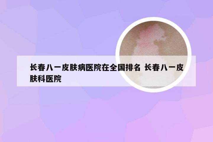 长春八一皮肤病医院在全国排名 长春八一皮肤科医院