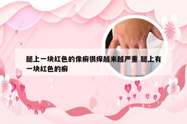 腿上一块红色的像癣很痒越来越严重 腿上有一块红色的癣