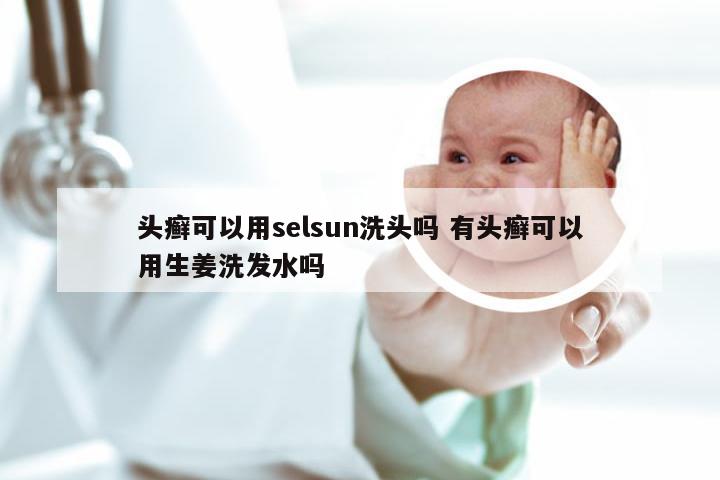 头癣可以用selsun洗头吗 有头癣可以用生姜洗发水吗