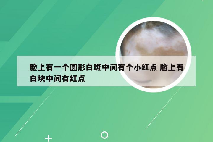 脸上有一个圆形白斑中间有个小红点 脸上有白块中间有红点