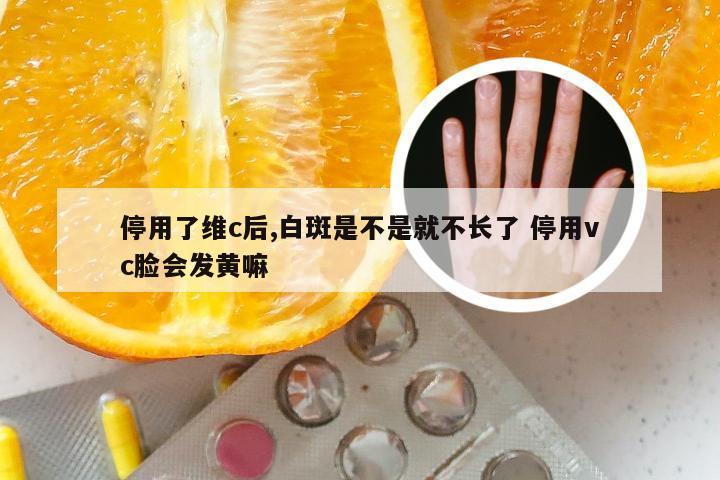 停用了维c后,白斑是不是就不长了 停用vc脸会发黄嘛