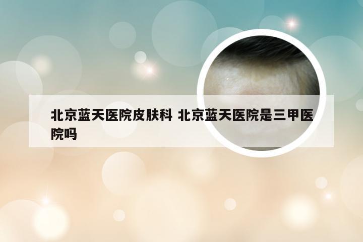 北京蓝天医院皮肤科 北京蓝天医院是三甲医院吗