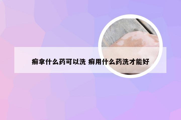 癣拿什么药可以洗 癣用什么药洗才能好