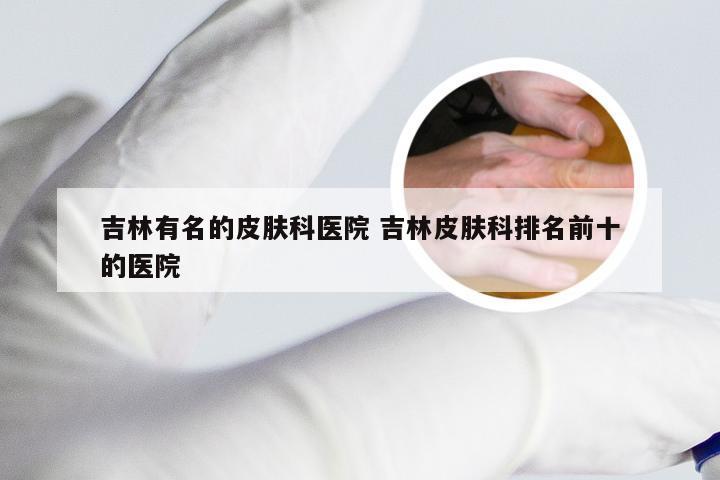 吉林有名的皮肤科医院 吉林皮肤科排名前十的医院
