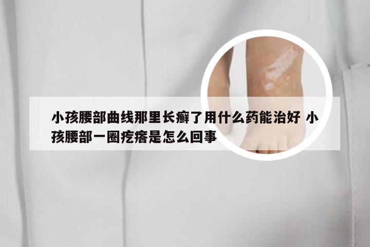 小孩腰部曲线那里长癣了用什么药能治好 小孩腰部一圈疙瘩是怎么回事