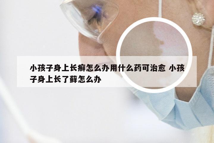 小孩子身上长癣怎么办用什么药可治愈 小孩子身上长了藓怎么办