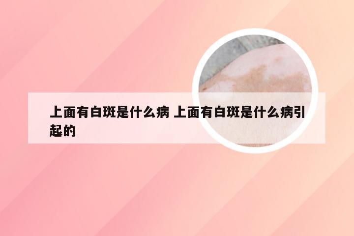 上面有白斑是什么病 上面有白斑是什么病引起的