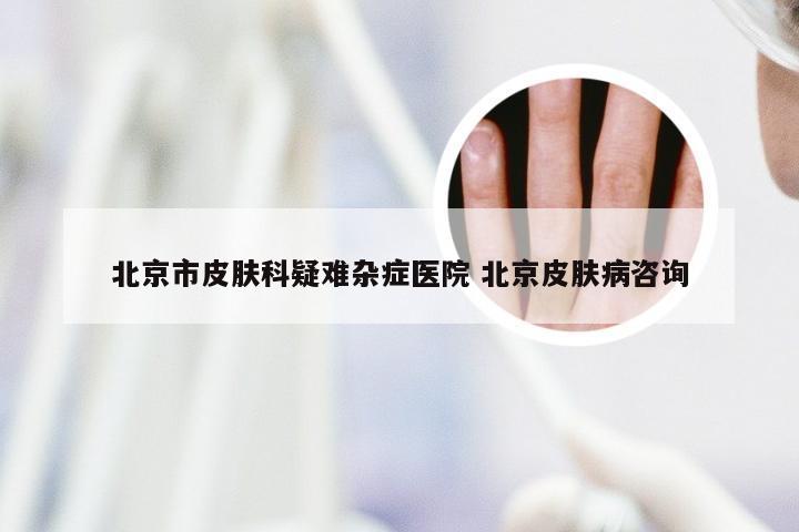 北京市皮肤科疑难杂症医院 北京皮肤病咨询
