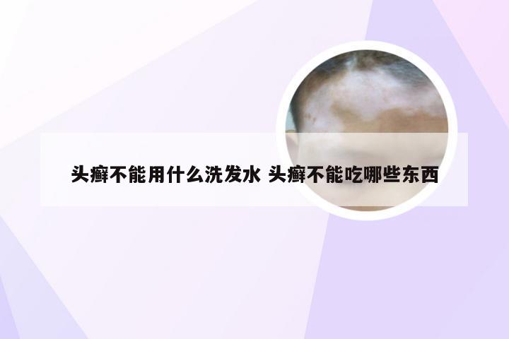 头癣不能用什么洗发水 头癣不能吃哪些东西