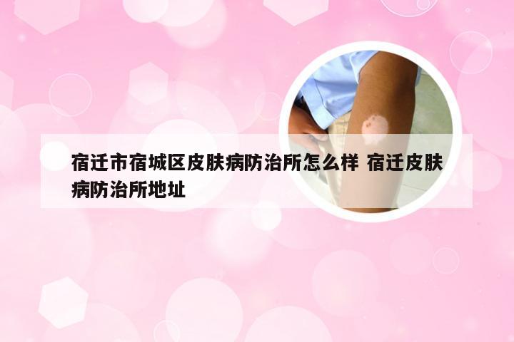 宿迁市宿城区皮肤病防治所怎么样 宿迁皮肤病防治所地址