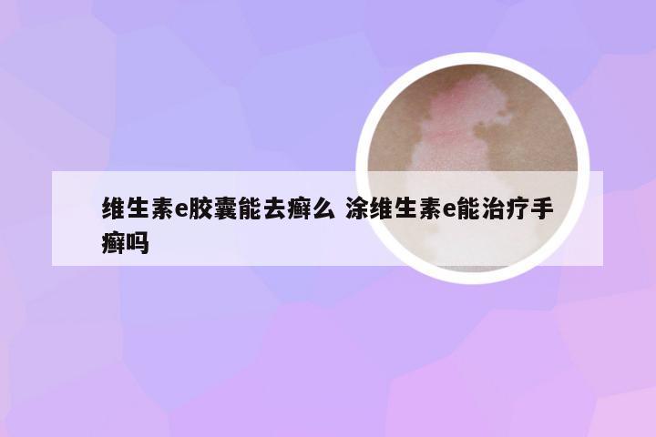 维生素e胶囊能去癣么 涂维生素e能治疗手癣吗