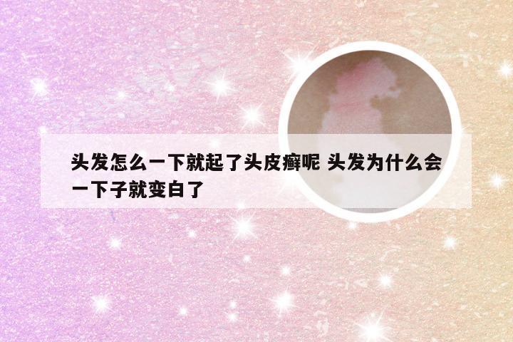 头发怎么一下就起了头皮癣呢 头发为什么会一下子就变白了