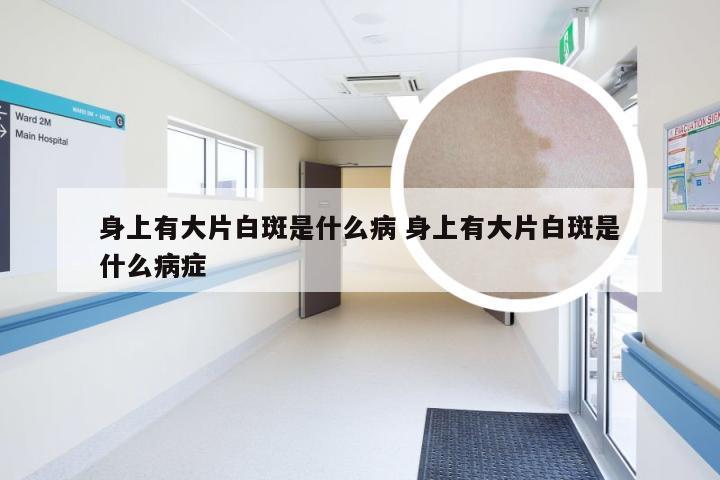 身上有大片白斑是什么病 身上有大片白斑是什么病症