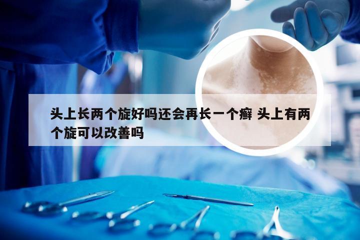 头上长两个旋好吗还会再长一个癣 头上有两个旋可以改善吗