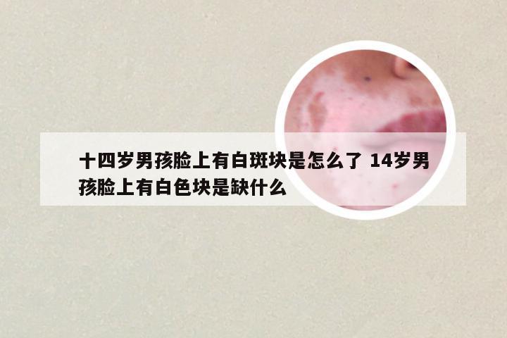十四岁男孩脸上有白斑块是怎么了 14岁男孩脸上有白色块是缺什么