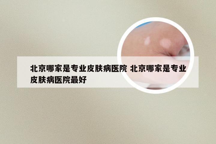北京哪家是专业皮肤病医院 北京哪家是专业皮肤病医院最好