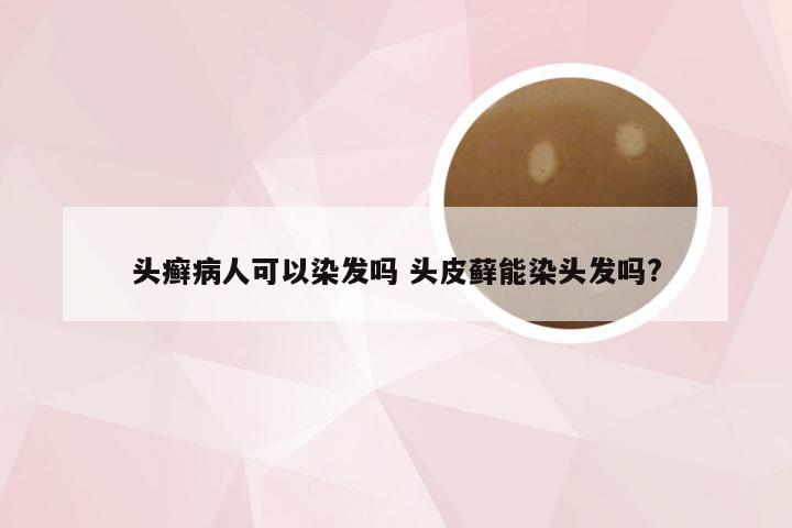 头癣病人可以染发吗 头皮藓能染头发吗?