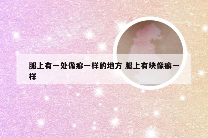腿上有一处像癣一样的地方 腿上有块像癣一样