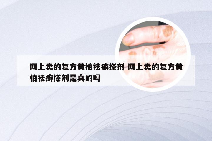 网上卖的复方黄柏祛癣搽剂 网上卖的复方黄柏祛癣搽剂是真的吗