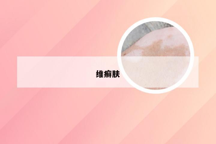 维癣肤
