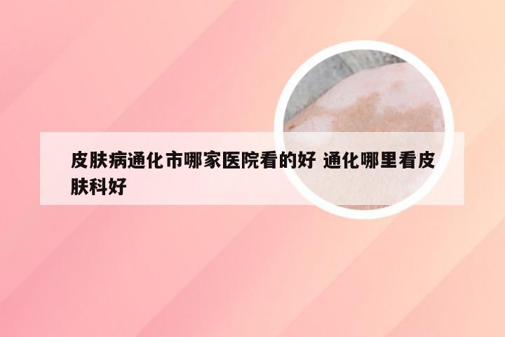 皮肤病通化市哪家医院看的好 通化哪里看皮肤科好