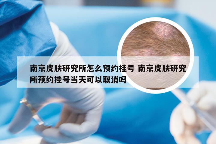 南京皮肤研究所怎么预约挂号 南京皮肤研究所预约挂号当天可以取消吗