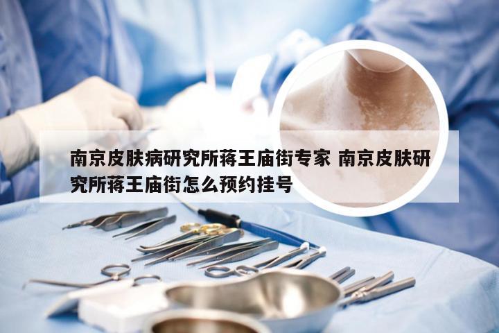 南京皮肤病研究所蒋王庙街专家 南京皮肤研究所蒋王庙街怎么预约挂号