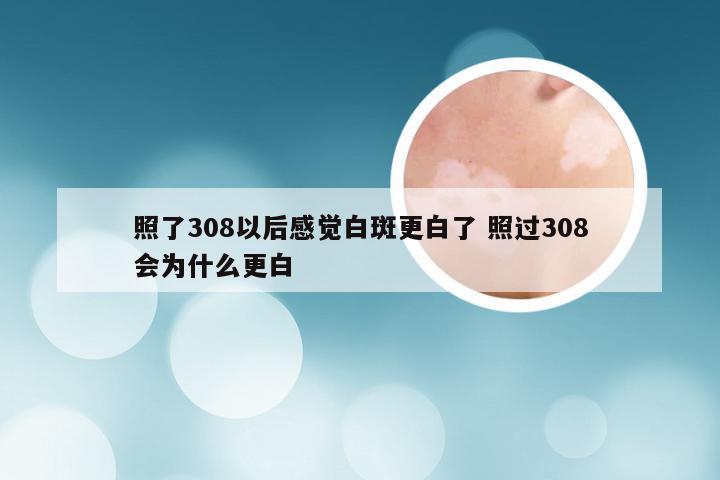 照了308以后感觉白斑更白了 照过308会为什么更白