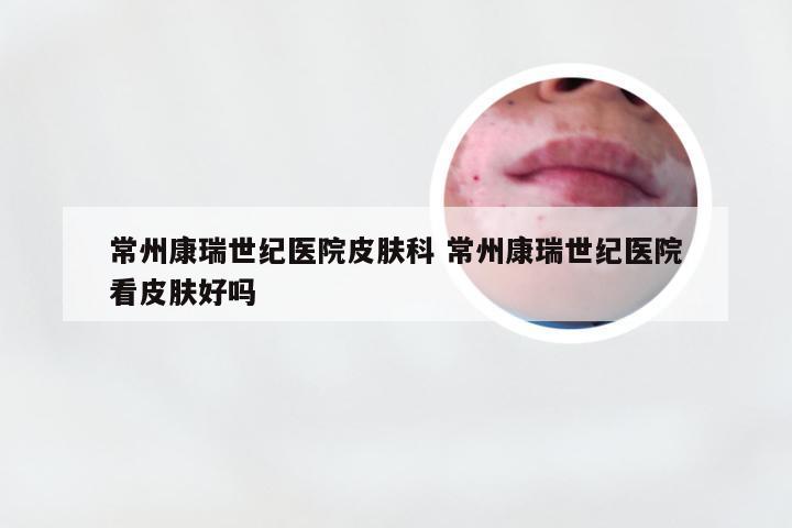 常州康瑞世纪医院皮肤科 常州康瑞世纪医院看皮肤好吗