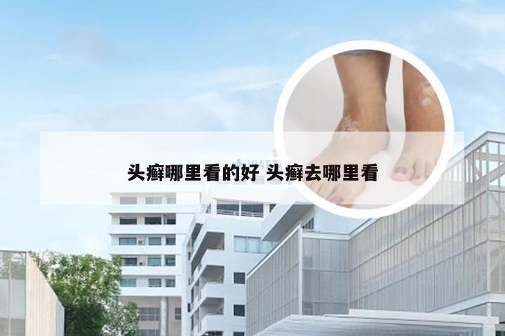 头癣哪里看的好 头癣去哪里看