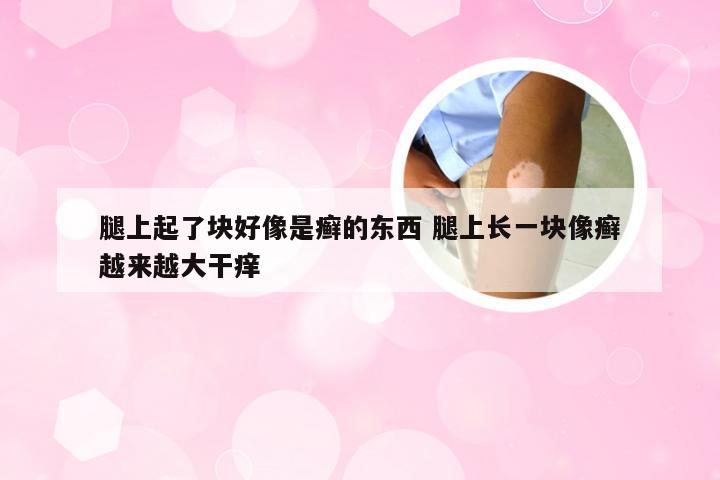 腿上起了块好像是癣的东西 腿上长一块像癣越来越大干痒