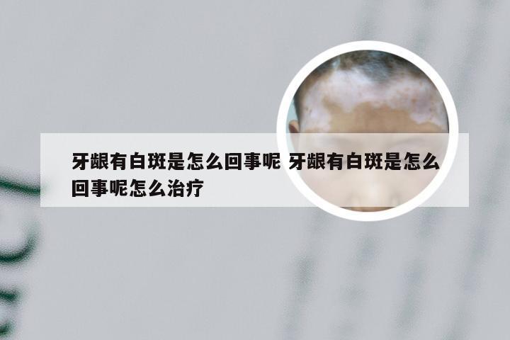 牙龈有白斑是怎么回事呢 牙龈有白斑是怎么回事呢怎么治疗