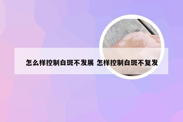 怎么样控制白斑不发展 怎样控制白斑不复发
