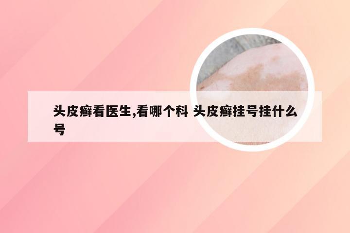 头皮癣看医生,看哪个科 头皮癣挂号挂什么号