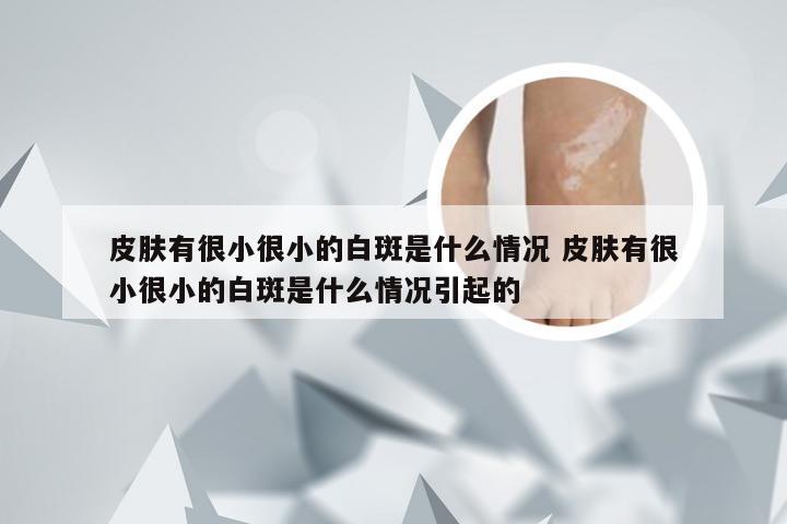 皮肤有很小很小的白斑是什么情况 皮肤有很小很小的白斑是什么情况引起的