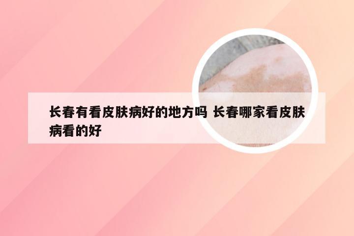 长春有看皮肤病好的地方吗 长春哪家看皮肤病看的好